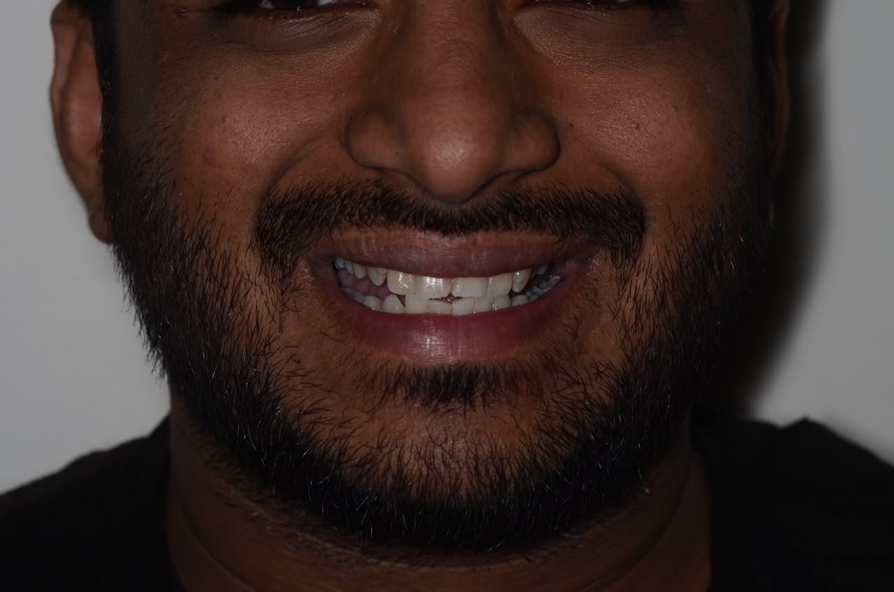 Before treatment