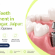 Missing Teeth Replacement in Malviya Nagar | Thaper Dental Clinic